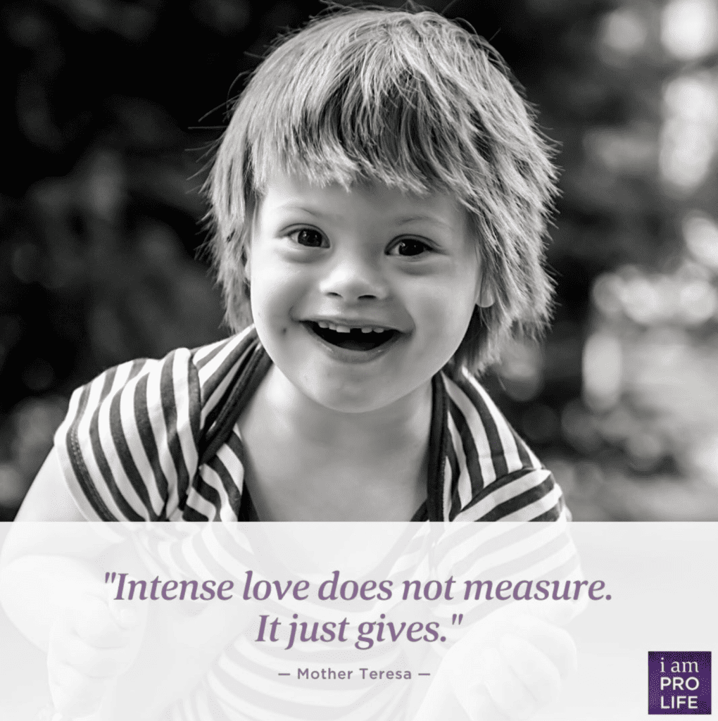 A quote for caring to all children with special needs saying, "Intense love does not measure, it just gives."